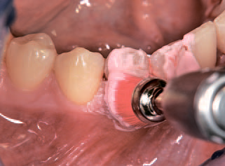 Полировальная щетка NTI - фото 2